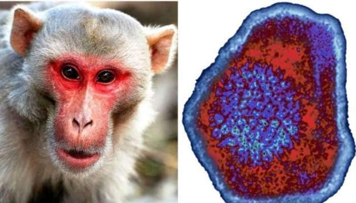 Monkey B Virus: தொற்று அறிகுறிகள், சிகிச்சை, பிற முக்கிய விபரங்கள் title=