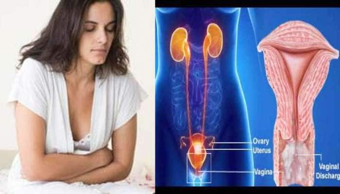 Home Remedies For White Discharge: வெள்ளைபடுகிறதா? கவலை வேண்டாம், சுலபமான தீர்வு title=