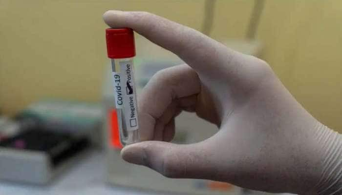 Blood Clot Risk: கொரோனா தடுப்பூசி போட்டுக் கொண்டவர்களுக்கு ரத்த உறைவு ஆபத்து குறைவு