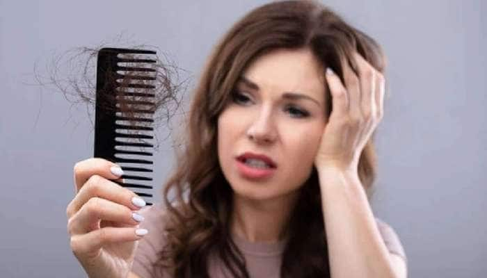 Hair care Tips: முடி உதிர்தலை தடுக்க ‘இந்த’ 4 பொருட்களே போதும்..!!! title=