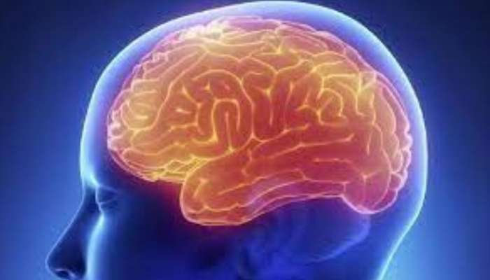 Brain Stroke எச்சரிக்கை தேவை: நோய்க்கான காரணம், அறிகுறிகள், தடுக்கும் முறைகள் இதோ 