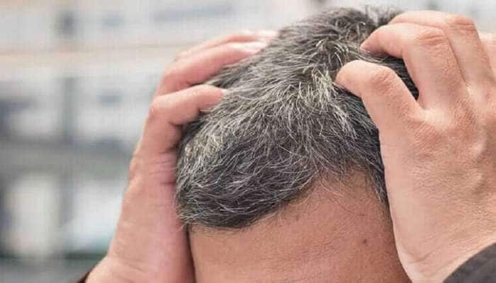 Grey Hair: இள நரை ஏற்படுவதற்கான முக்கிய காரணங்கள்..!!