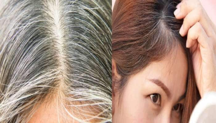 Grey Hair: நரை முடிக்கு  நிரந்திர  தீர்வு தரும் ‘3’ வீட்டு வைத்தியங்கள்!