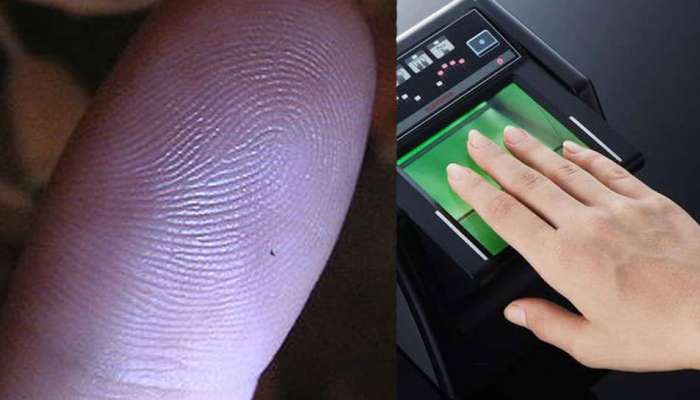 Fingerprints: தீக் காயங்களால் ‘கை விரல் ரேகைகள்’ மாறுமா; உண்மை என்ன!