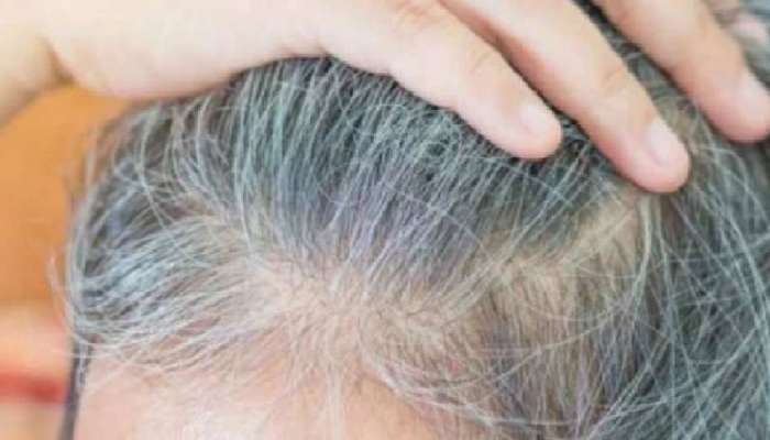 This leaf will help to solve the problem og white hair fastly | வெள்ளை  முடியை கருமையாக்க இந்த இலையை பயன்படுத்துங்க | Health News in Tamil