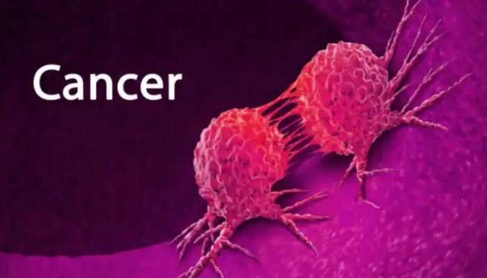 Cancer: புற்று நோய் அண்டாமல் இருக்க ‘இந்த’ மசாலாவை உணவில் தினமும் சேர்க்கவும்!