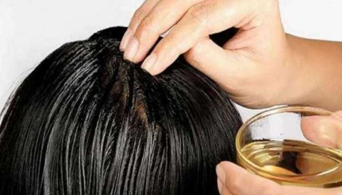 Worst Oil for Hair: தலையில் வழுக்கையை உண்டாக்கும் 5 எண்ணெய்கள்!   title=