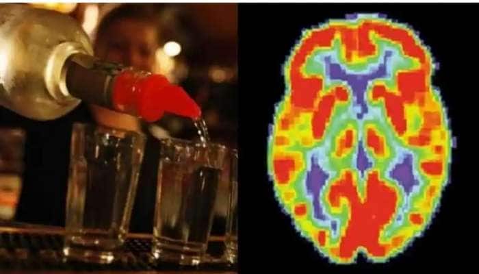 Drink vs Brain: மதுப்பிரியர்களுக்கு அதிர்ச்சி தரும் ஆய்வு? இரவு நேரத்தில் மது அருந்துவது மூளையை பாதிக்கும்!