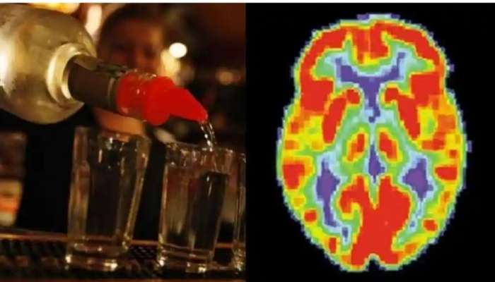 Drink vs Brain: மதுப்பிரியர்களுக்கு அதிர்ச்சி தரும் ஆய்வு? இரவு நேரத்தில் மது அருந்துவது மூளையை பாதிக்கும்! title=