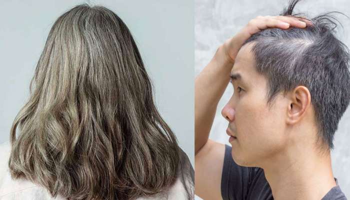 Hair Care Tips: Turn Grey Hair Black easily, naturally | நரைமுடி பிரச்சனையா? இந்த தோல் இருந்தால் போதும், எளிதாக தீர்வு காணலாம் | Health News in Tamil Hair Care Tips: Turn Grey Hair Black easily, naturally | நரைமுடி பிரச்சனையா? இந்த தோல் இருந்தால் போதும், எளிதாக தீர்வு காணலாம் | Health News in Tamil