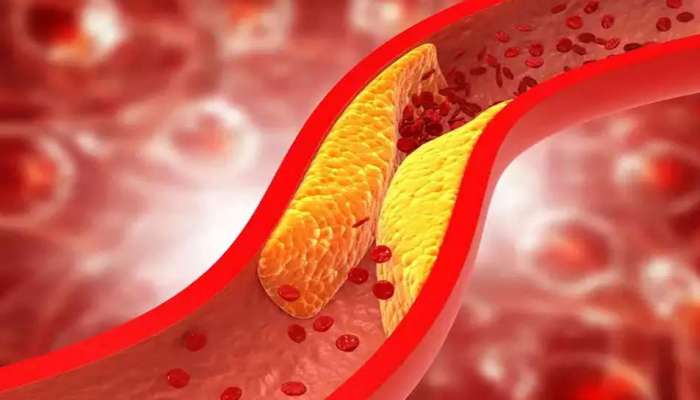 Good Cholesterol அளவை எளிதாக அதிகரிக்க சூப்பர் வழிகள் இதோ