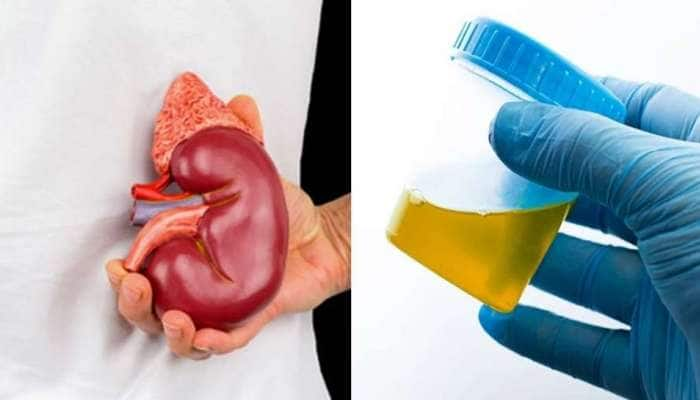 Kidney Failure: சிறுநீர் இந்த நிறத்தில் வருகிறதா? சிறுநீரக செயலிழப்புக்கான அறிகுறி