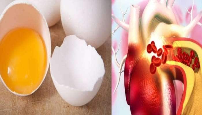 High Cholesterol Foods: இந்த 5 பொருட்களில் அதிகளவு கொலஸ்ட்ரால் உள்ளது