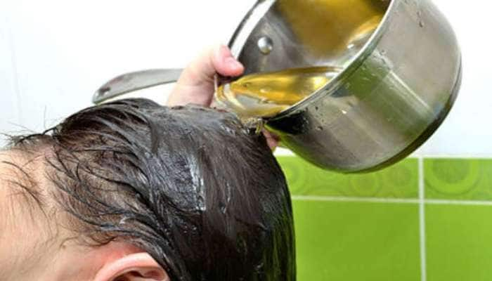 Hair loss Treatment: முடி உதிர்விலிருந்து விடுபட ஸ்பெஷல் மூலிகை தண்ணீர் title=