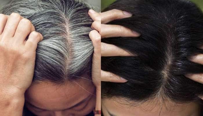 Premature White Hair Turn Black Naturally at Home | வெள்ளை முடியை விரட்ட  அற்புதமான இயற்கை வீட்டு வைத்தியம் | Health News in Tamil