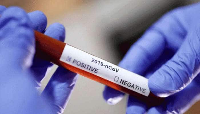 சிப்லாவின் புதிய RT-PCR கிட்; வெறும் 45 நிமிடங்களில் ரிசல்ட்