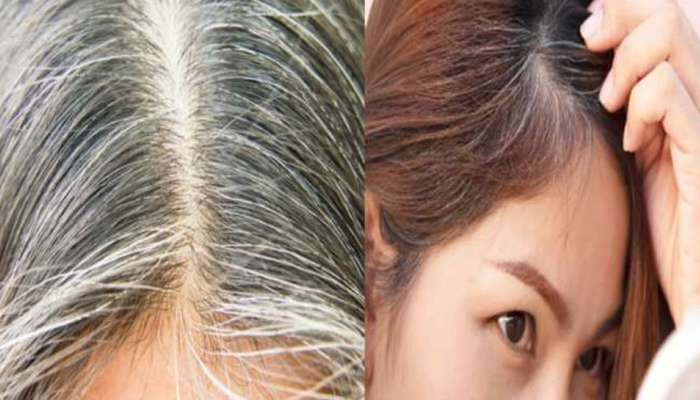 Premature White hair to black hair naturally try these tips | முடி நரைக்காம  கருப்பாவே இருக்க தயிர், உருளைக்கிழங்கு போதும் | Health News in Tamil