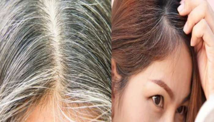 Premature White hair to black hair naturally try these tips | முடி நரைக்காம கருப்பாவே இருக்க தயிர், உருளைக்கிழங்கு போதும் | Health News in Tamil Premature White hair to black hair naturally try these tips | முடி நரைக்காம கருப்பாவே இருக்க தயிர், உருளைக்கிழங்கு போதும் | Health News in Tamil