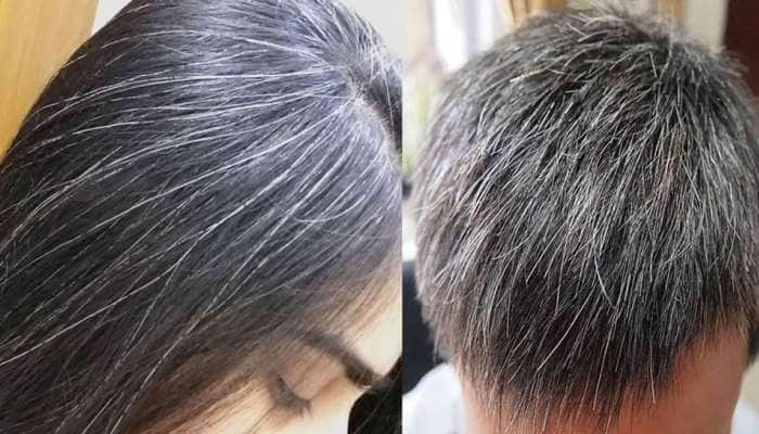 White Hair Problem: நரை முடி கருப்பாக மாற இதை ஃபாலோ பண்ணுங்க title=