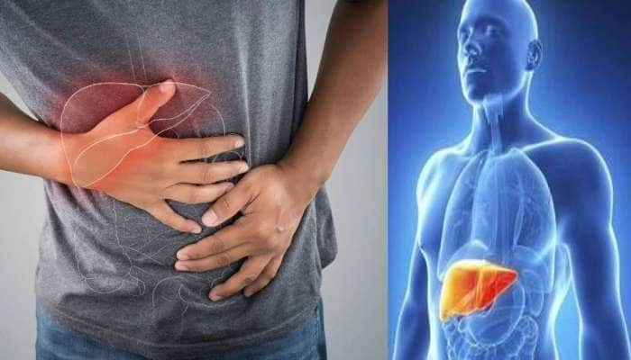 Fatty Liver: சர்க்கரை அதிகம் சாப்பிடுகிறீர்களா; இந்த செய்தி உங்களுக்குத் தான்