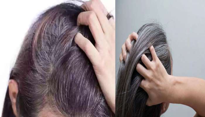 White Hair To Keep White Hair Away Apply this Oil | வெள்ளை முடியை கருமையாக்க இந்த மூலிகை ஆயிலை பயன்படுத்துங்கள் | Health News in Tamil White Hair To Keep White Hair Away Apply this Oil | வெள்ளை முடியை கருமையாக்க இந்த மூலிகை ஆயிலை பயன்படுத்துங்கள் | Health News in Tamil