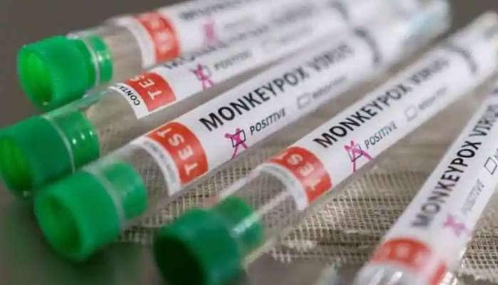 UAE Monkeypox Update: 4 பேர் புதிதாக குரங்கு அம்மை தொற்றால் பாதிக்கப்பட்டனர்