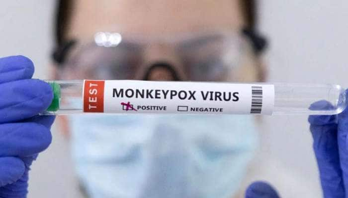 Monkeypox Update: குரங்கு அம்மை தொற்றால் பாதிக்கப்பட்டவர்களின் எண்ணிக்கை 780 ஆக உயர்ந்தது title=