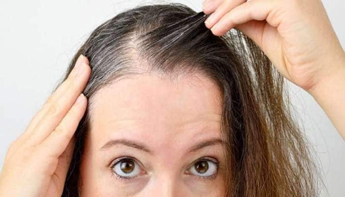 Hair Care Tips: Apply this Oil in Hair for White Hair Problem | நரைமுடி  பிரச்சனையா: வாரம் 2 நாட்களுக்கு இந்த எண்ணெயை தடவினால் போதும் | Health News  in Tamil