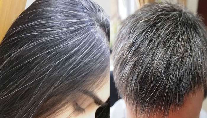 premature white hair problem, home remedies tips are here | White Hair  Problem: நரை முடியை கருமையாக்க இதை செய்தால் போதும் | Health News in Tamil
