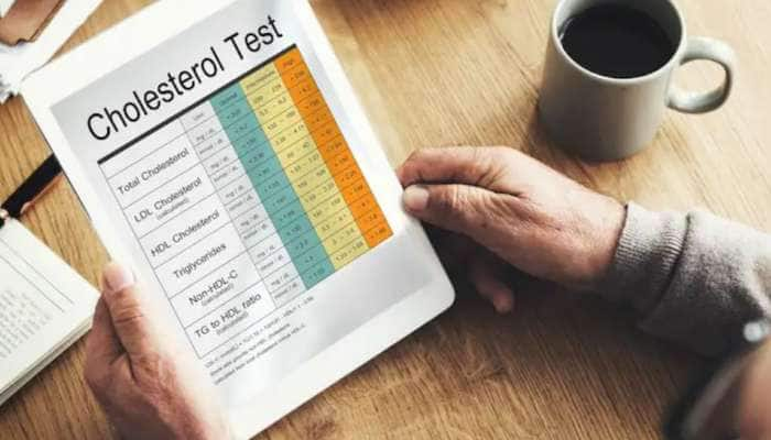 Control Cholesterol: இவ்வளவு ஈஸியா கொலஸ்ட்ராலை கட்டுப்படுத்த முடியுமா