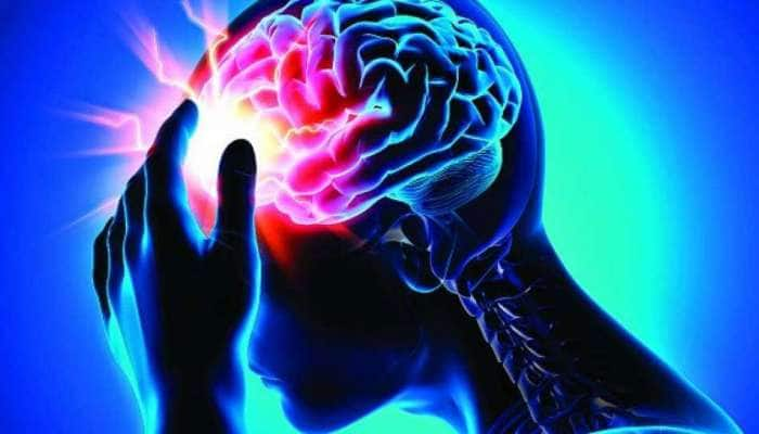 Brain Health: மூளையின் செயல் திறனை பாதிக்கும் சில உணவுகள்