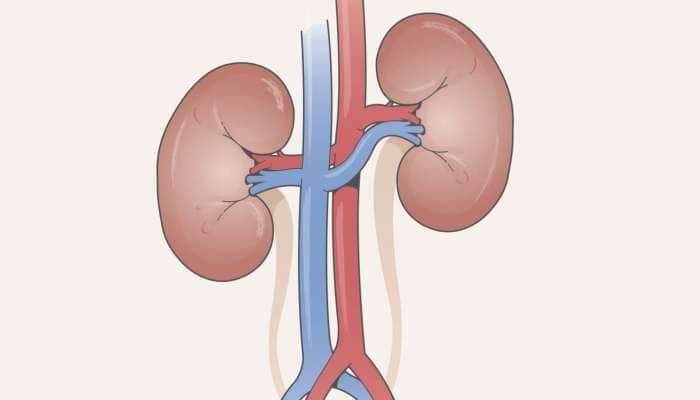 சிறுநீரகம் சிறப்பாக செயல்பட உதவும் 5 சூப்பரான உணவுகள்!