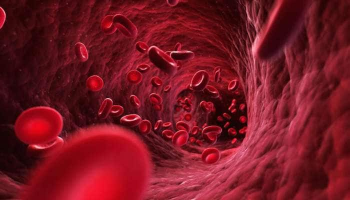 Anemia: இரத்த சோகையை சரி செய்ய உதவும் சூப்பர் உணவுகள், இன்றே சாப்பிடுங்கள்