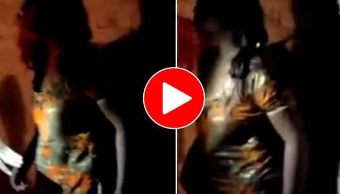 Viral Video: சின்ன விசியத்துக்காக கட்டுன புருஷனை இப்படி அடிப்பது.. பாவம் 15 தையல்கள் title=