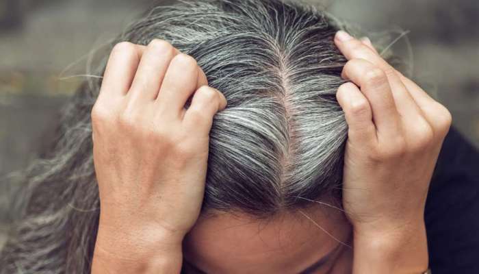 White Hair Problem: நரை முடி கருப்பாக மாற இயற்கை வைத்தியம்