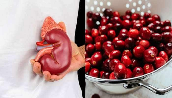 Food For Kidney: சிறுநீரகத்தை சுத்தம் செய்யும் உணவுகள்