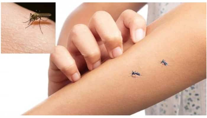 Mosquito Repellent: கொசு கடியிலிருந்து தப்ப வீட்டிலேயே தயாரிக்கலாம் ‘சூப்பர்’ லோஷன்!  title=