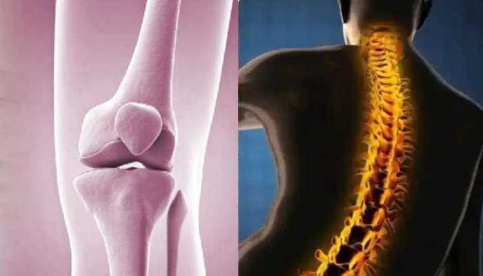 Osteoporosis:எலும்புகளின் கால்ஷியத்தை உறிஞ்சும் ‘சில’ உணவுகள்!  title=