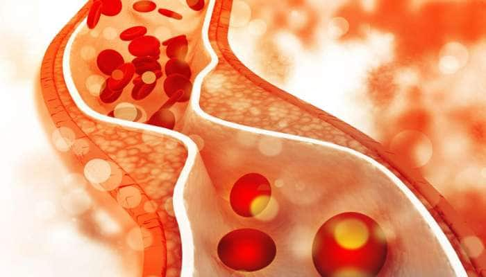 Cholesterol Diet: கொலஸ்ட்ராலை குறைக்கணுமா? இந்த மேஜிக் பழங்களை உட்கொண்டால் போதும்