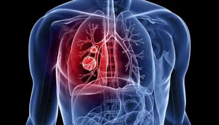 Lungs Health: சுவாசத்திற்கு ஆதாரமான ‘நுரையீரல்’ வலுப்பெற செய்ய வேண்டியவை!