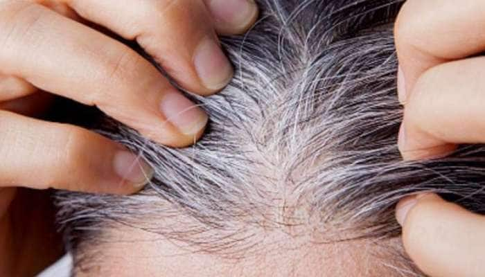 Grey hair: இளநரையைத் தடுக்கும் ‘5’ சிறந்த இயற்கை வைத்தியங்கள்!