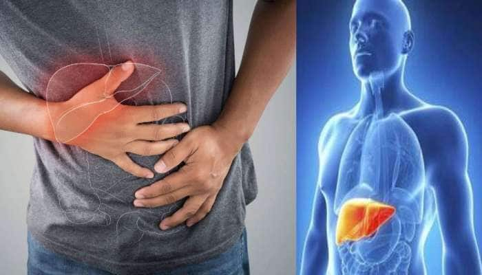 Fatty Liver பிரச்சனை பாடாய் படுத்துதா? இந்த காய்கறிகளை கண்டிப்பா சாப்பிடுங்க