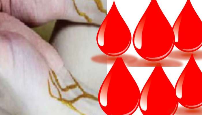 Golden Blood: தங்கத்தை விட விலையுயர்ந்த ஒரு சொட்டு ரத்தம்! விலை பொன்னை விட அதிகம் title=