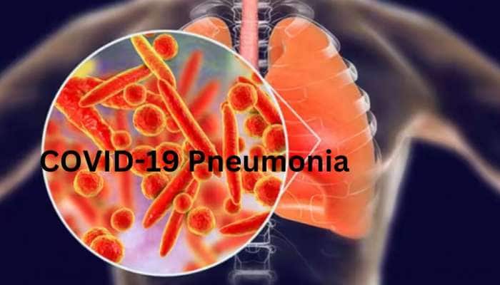 Corona Pneumonia: கடுமையான நிமோனியாவை ஏற்படுத்தும் கொரோனாவின் அடுத்த அட்ராசிடி title=