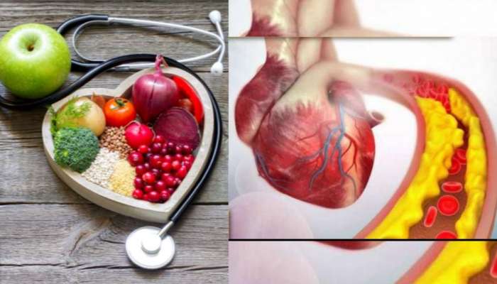 Heart Health: இதய தமனிகளில் சேரும் கொழுப்பை எரிக்கும் ‘சில’ பழங்கள்! title=