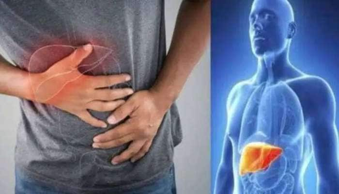 Liver Health: ‘இந்த’ அறிகுறிகள் கல்லீரால் பாதிப்பின் எச்சரிக்கை மணிகள்!