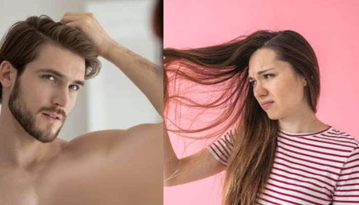 Hair Care: உங்கள் முடி எண்ணெய்ப்பசையா இருக்கா? இந்த வீட்டு வைத்தியங்களை உபயோகித்து பாருங்கள்! title=