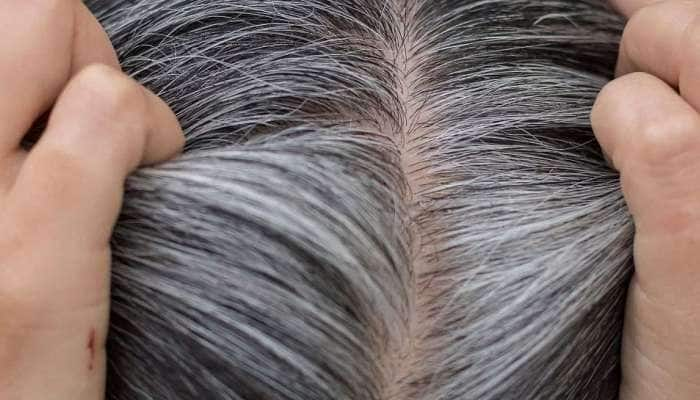 White Hair Solution: வெரி சிம்பிள்! உங்கள் நரை முடி கருமையாக மாற இதை செய்யுங்கள்!