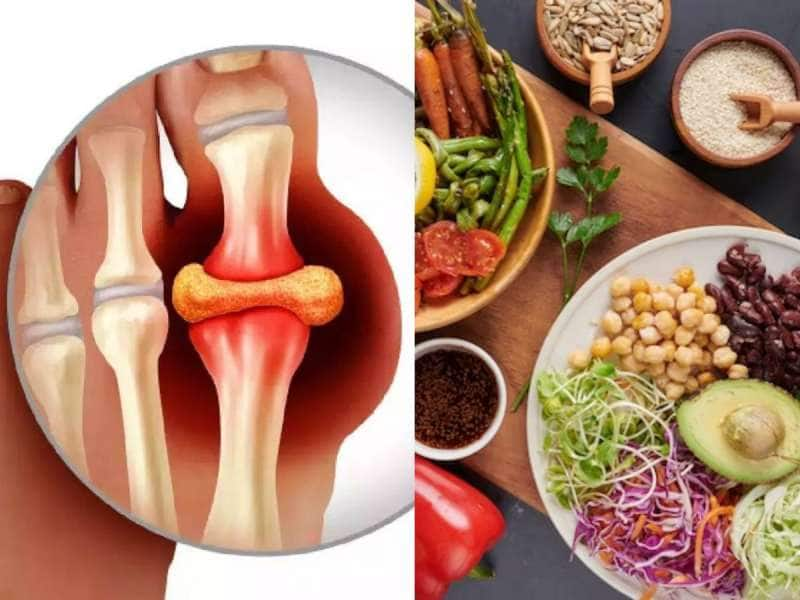 யூரிக் அமிலத்தை குறைக்க சிறப்பான வழி! 3 மாதங்களுக்கு நோ அசைவம்! ஒன்லி சைவம்