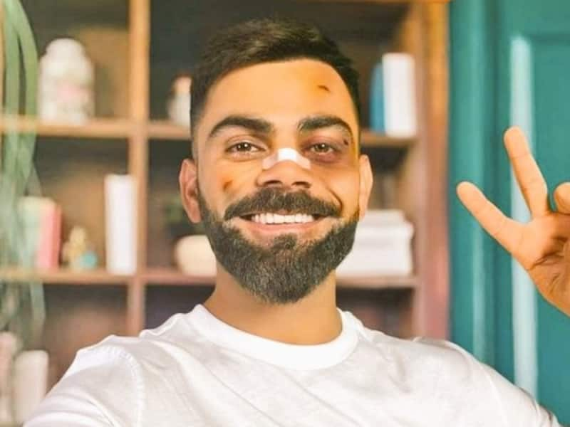 Shocking Viral Photo Of Virat Kohli Facial Injury In His Instagram ...